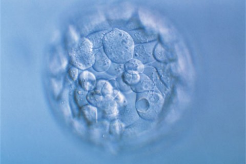 http://zhongshan.quanwangkm.com/post/190.html|中山人工试管